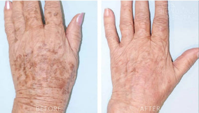 5 Tips To Rejuvenate Your Aging Hands