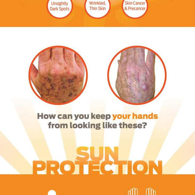 An Innovative Way to Protect the Back of Your Hands from Sun Damage